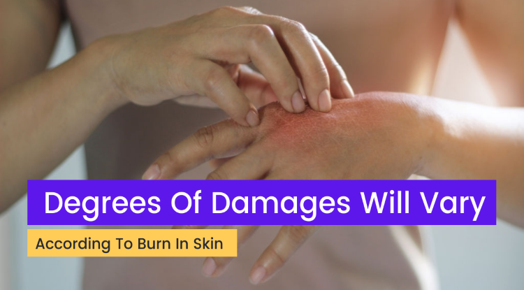 Water Can Make Burn In Your Skin;