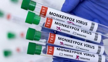 California on Red Alert! Untoward surge of Monkey pox cases!